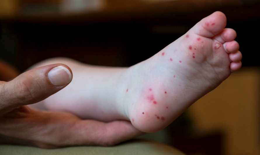 Antabax dan R.E.A.L Kids Berganding Benteras Penyebaran Penyakit Tangan, Kaki, dan Mulut (HFMD)